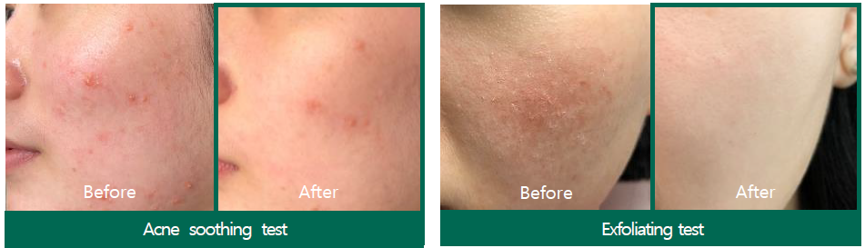 SOMEBYMI AHA-BHA-PHA Miracle Starter Mini Kit