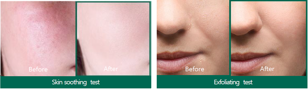 SOMEBYMI AHA-BHA-PHA Miracle Starter Mini Kit