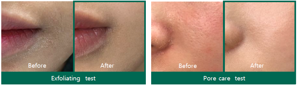 SOMEBYMI AHA-BHA-PHA Miracle Starter Mini Kit